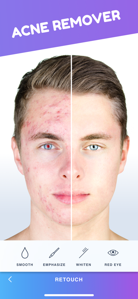 Body Tune for Men－Photo Editor - A before and after side-by-side comparison of a man's face using the acne remover feature in the Body Tune for Men app.