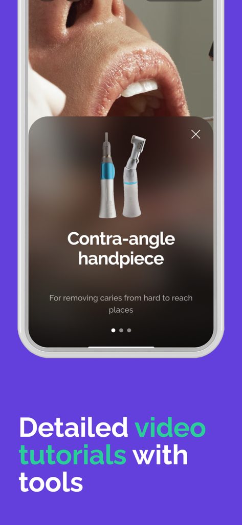 덴탈 스킬 앱에서 대합각 핸드피스에 대한 상세 비디오 튜토리얼을 보여주는 모바일 앱 스크린샷
