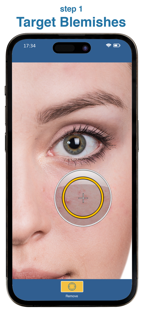 Blemish Remover Photo Tool - Primer plano de un rostro con una herramienta de selección apuntando a una imperfección para eliminarla en la aplicación