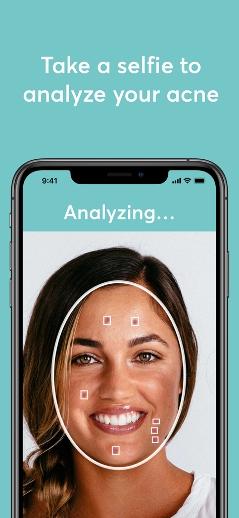 MDacne - Custom Acne Treatment - Interface de l'application mobile MDacne montrant l'analyse de peau par IA à partir d'un selfie