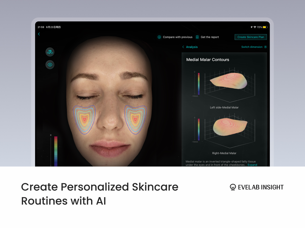EveLab Insight - Eve V - Interfaz de iPad de EveLab Insight mostrando análisis de contorno malar medial 3D y características de rutina de cuidado de la piel personalizadas.
