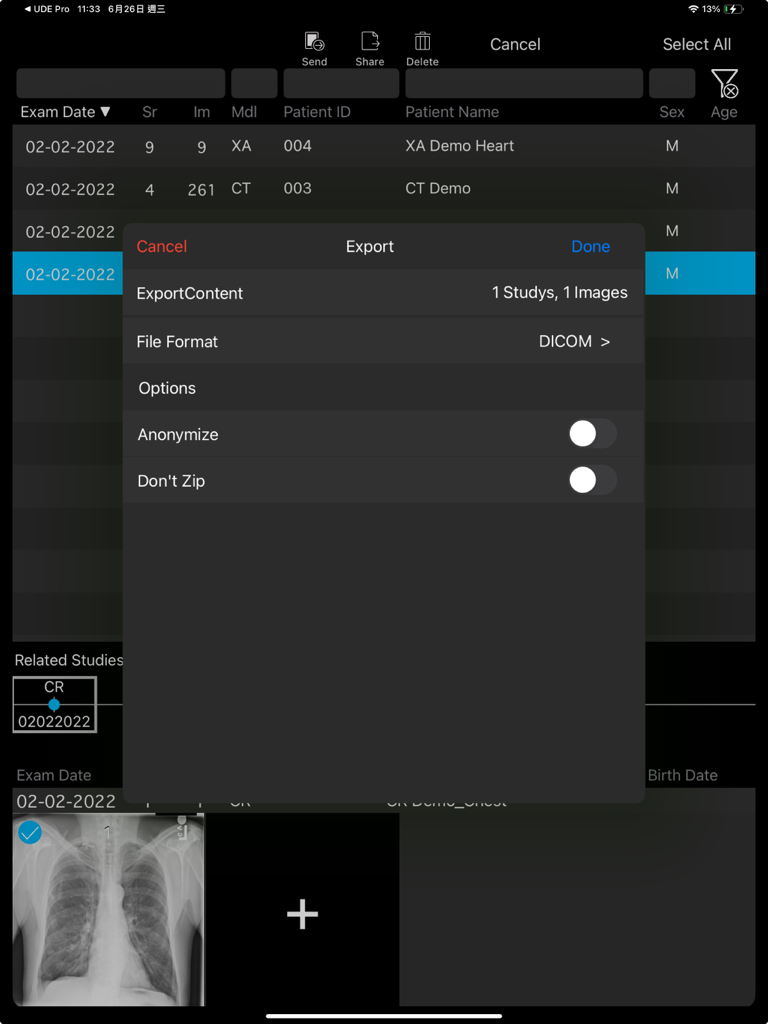 UDE Lite medical app interface showing export options for DICOM imaging studies including anonymization and file format selection