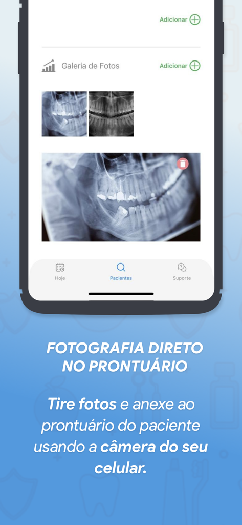 A smartphone screen showing the Codental app photo gallery with dental x-rays and records.