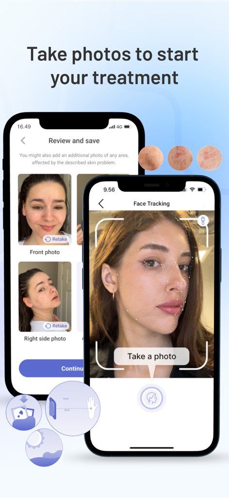Miiskin: Rx Dermatology Visits - Miiskin app face tracking screen for online dermatology consultation