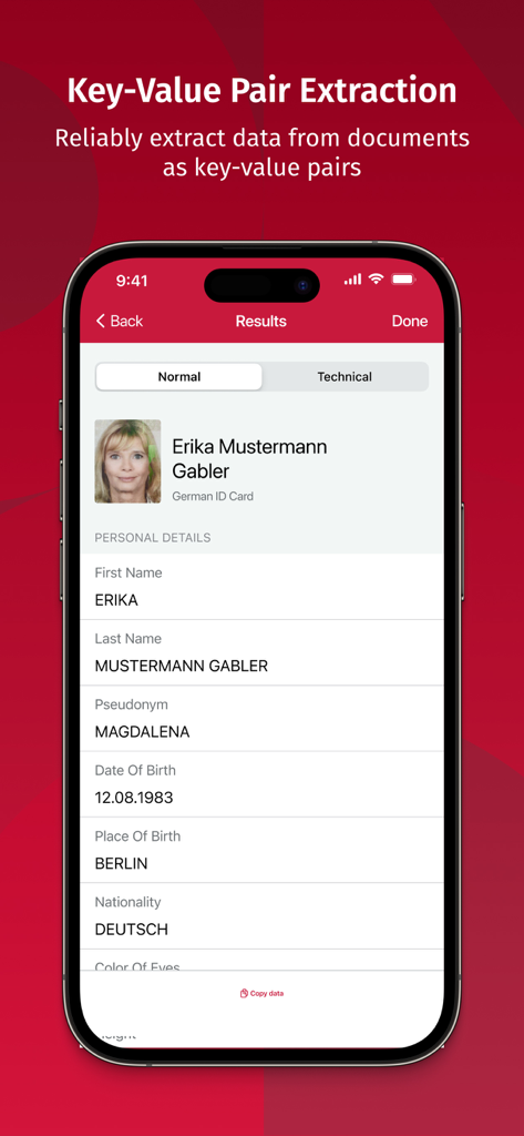 Mobile interface of Scanbot SDK displaying key-value pair extraction results from a German ID card.