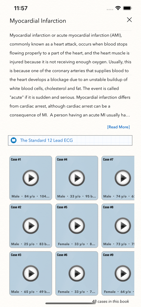 ECG Books Pro - List of clinical cases for myocardial infarction in the ECG Books Pro app