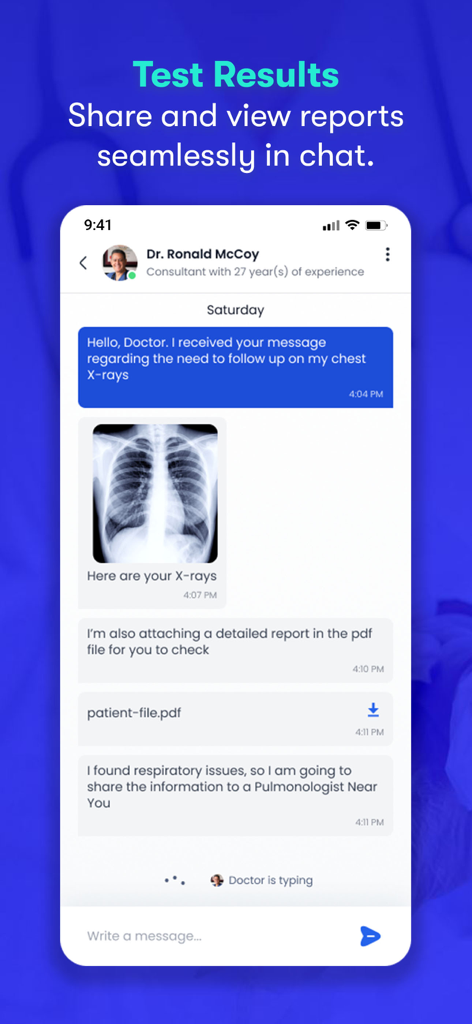 Una schermata mobile dall'app CureMe che mostra una conversazione di chat sicura in cui un medico condivide i risultati dei raggi X e i file medici
