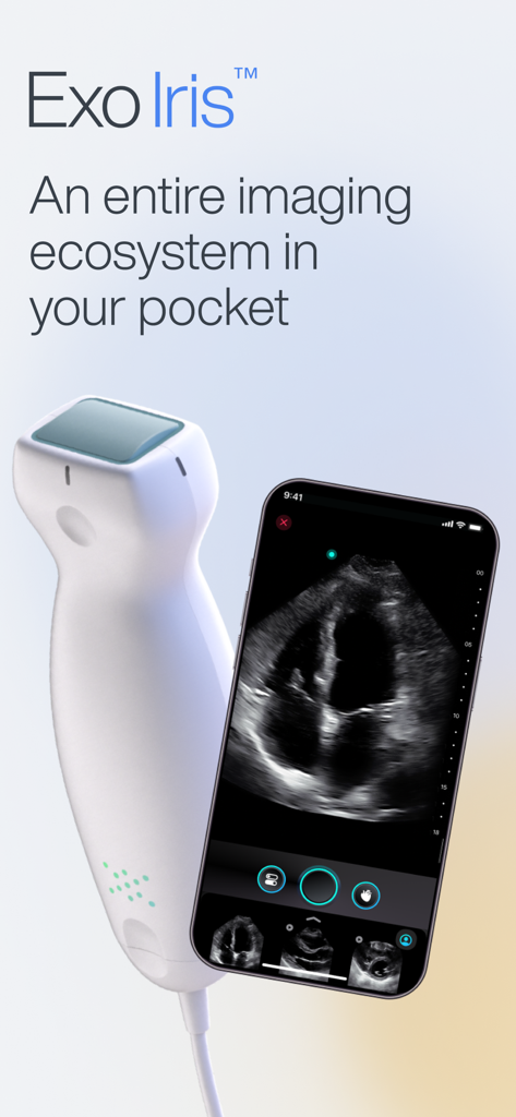 Exo Iris™ - Exo Iris handheld ultrasound probe and smartphone displaying a cardiac imaging scan