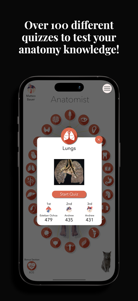 Anatomist – The Anatomy Game - Interface of the Anatomist app showing a lung anatomy quiz popup with a global leaderboard