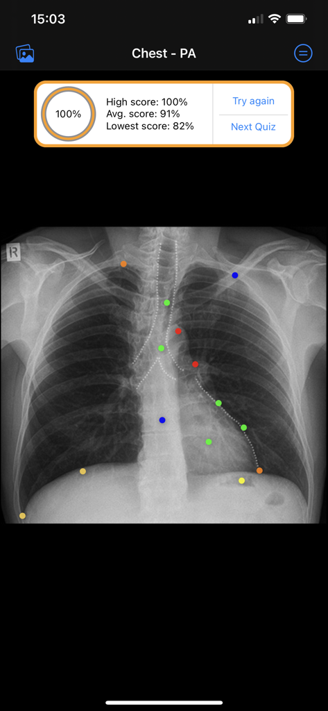 Chest X-ray PA projection quiz result showing a 100 percent score and colored anatomical markers.