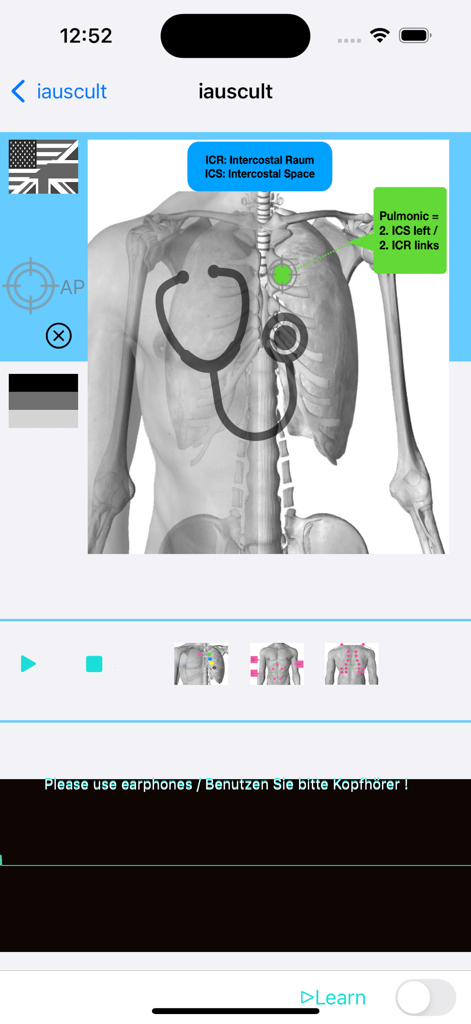 iauscultアプリの画面。聴診器のアイコンが肺聴診ポイントにある人間の胴体図が表示されています。