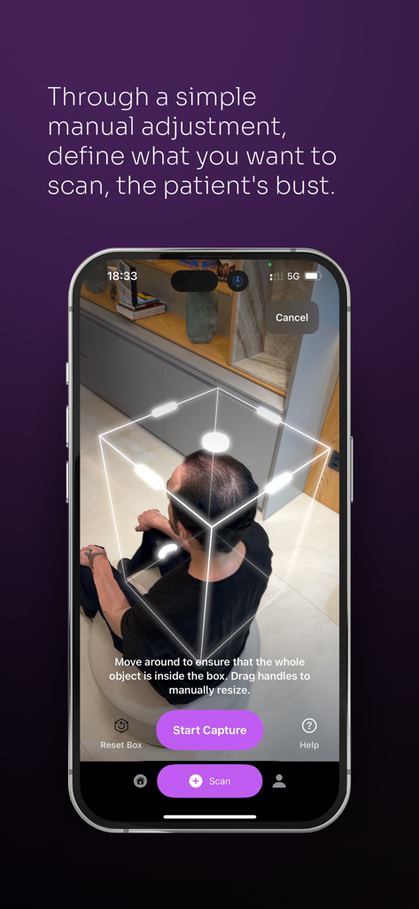 ScalpScan.AI app interface showing augmented reality 3D scanning of a patient scalp for hair restoration planning