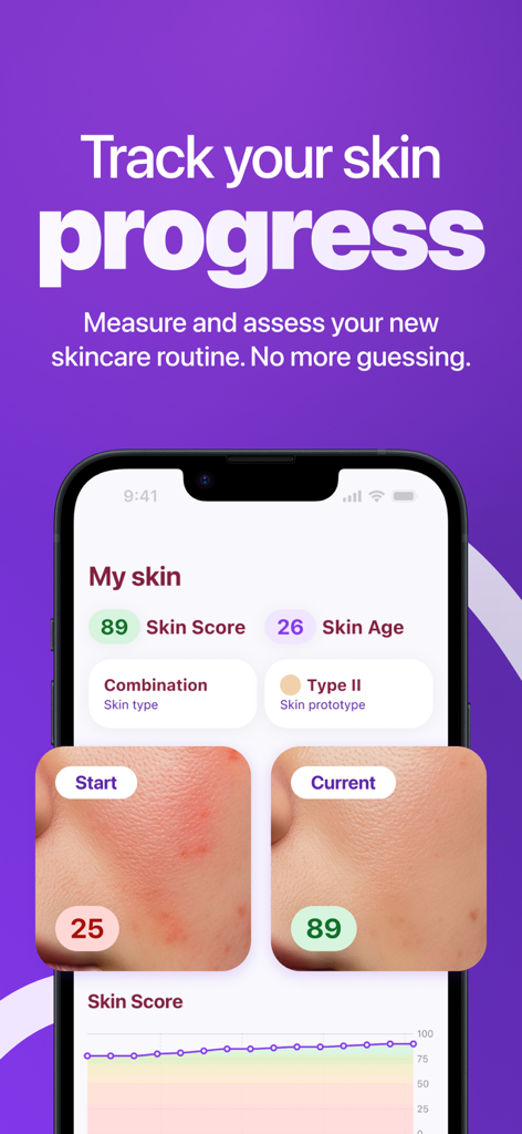 Alba - Skin Care Routine - Alba app interface showing skin progress with before and after comparison and skin score analytics