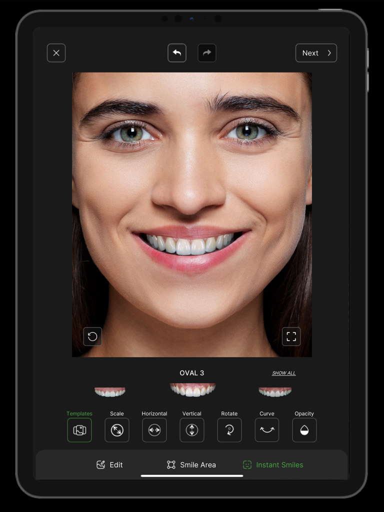 Instant Smiles - 미용 치과 상담을 위한 iPad의 디지털 스마일 목업 인터페이스