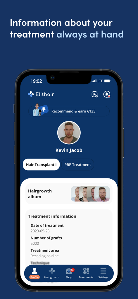 Elithair - Elithair app dashboard showing patient treatment details like graft count and hair growth progress.
