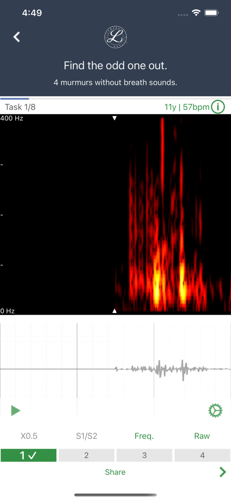 Interfaz de la aplicación Littmann University que muestra un espectrograma de sonido cardíaco y una tarea de aprendizaje para identificar soplos.