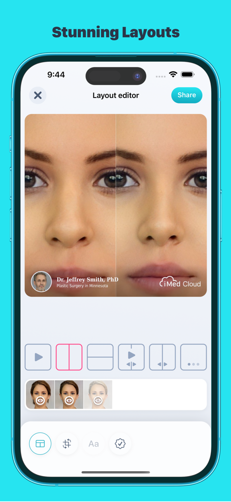 Editor del layout dell'app iMed HIPAA cloud che mostra un confronto fotografico medico prima e dopo affiancato.
