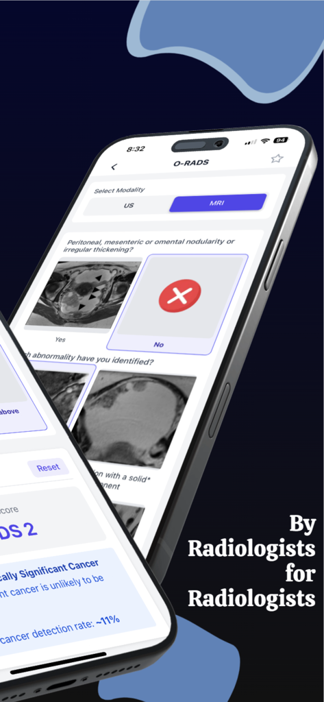 Radiology Calculators app showing the O-RADS MRI diagnostic criteria and scoring system.