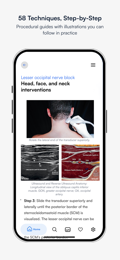 NYSORA Ultrasound Pain - NYSORA App, die eine schrittweise Nervenblockade-Prozedur mit Ultraschall und anatomischen Illustrationen zeigt