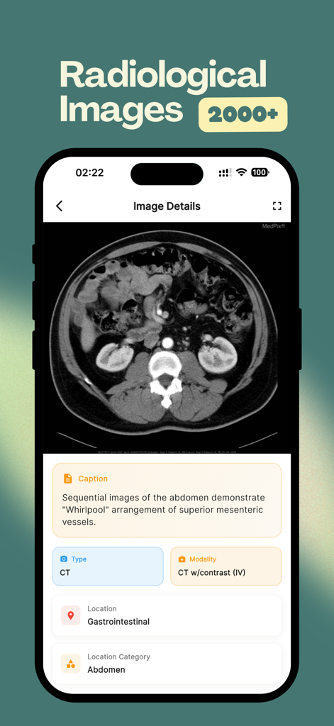 MedDose Pro - MCQs & Diseases - A radiological CT scan of an abdomen displayed within the MedDose Pro medical app interface.
