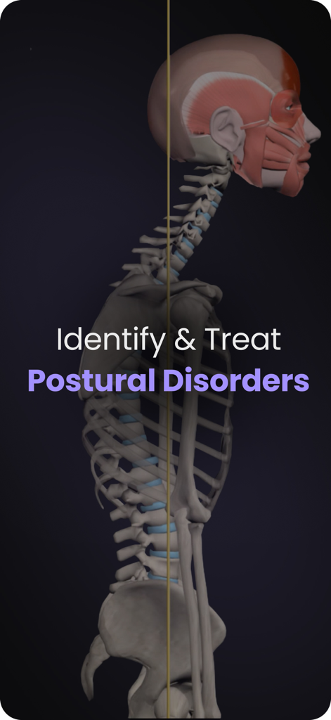 3D anatomical skeleton model showing postural disorders for identification and treatment