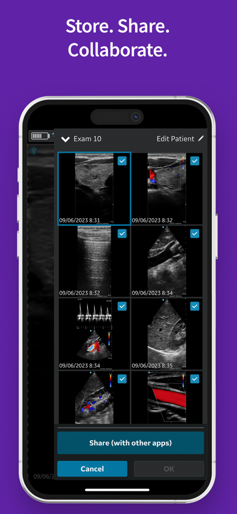 Interface do aplicativo Vscan Air VET para armazenar e compartilhar imagens de exames de ultrassom veterinário