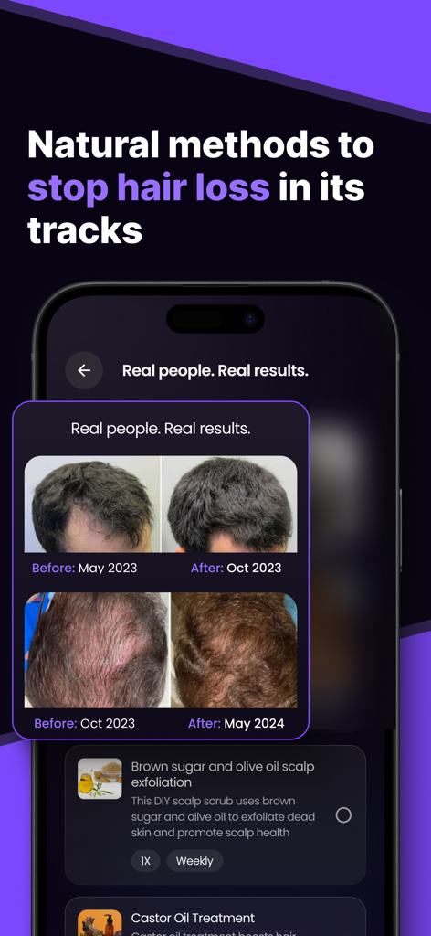 Before and after results of hair growth progress with natural scalp treatment plans