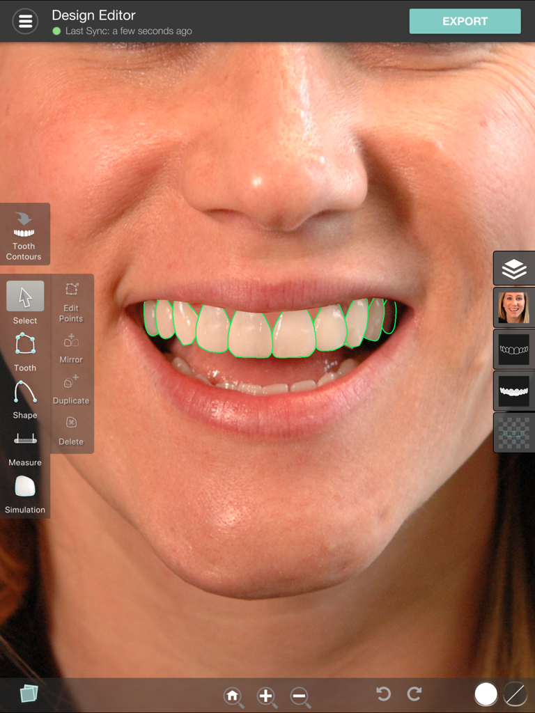 Digital dental software interface showing precise tooth contouring and smile design on a patient photo.