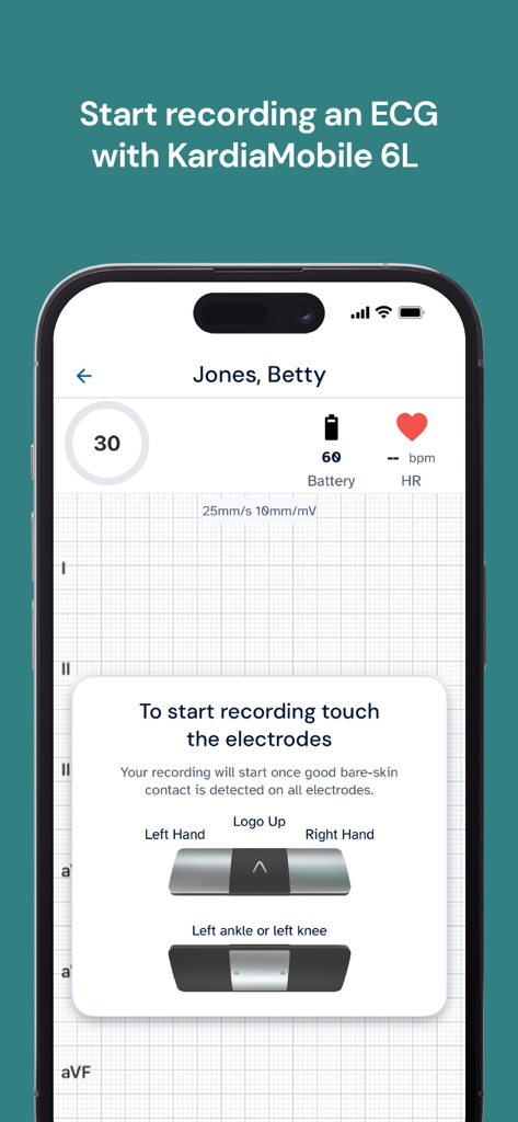 KardiaStation Professional - Interfaz de KardiaStation Professional que muestra instrucciones de grabación de ECG y colocación de electrodos.