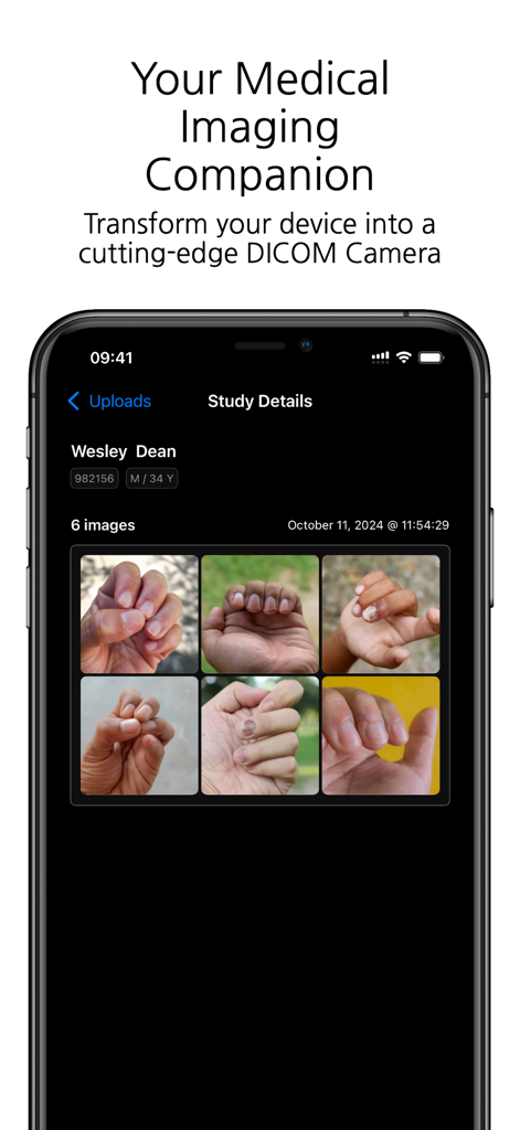 DICOM Camera - Smartphone screen displaying the DICOM Camera app with clinical study details and patient hand images