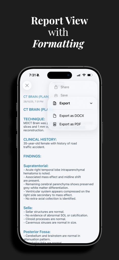 Formatted radiology report in the TextRad app with export menu for PDF and DOCX