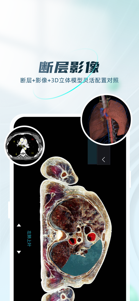 数字人解剖学STEM系统 - Mobile app interface displaying a human anatomical cross-section alongside a CT scan and a 3D lung model.