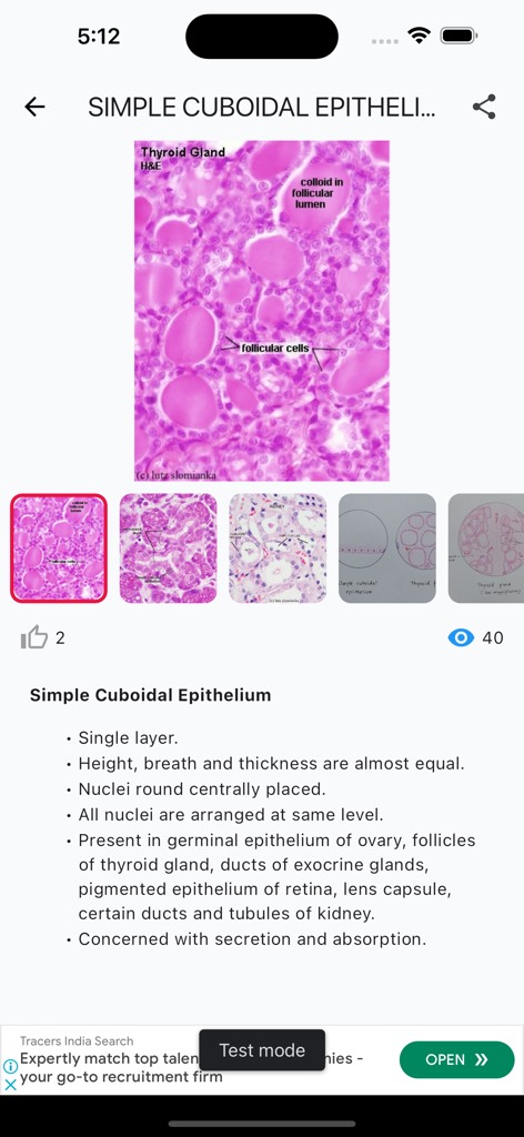 HistoGrams⁺ - 의대생을 위한 단순 입방 상피에 대한 현미경 갑상선 이미지와 요약 노트를 보여주는 HistoGrams 앱 화면