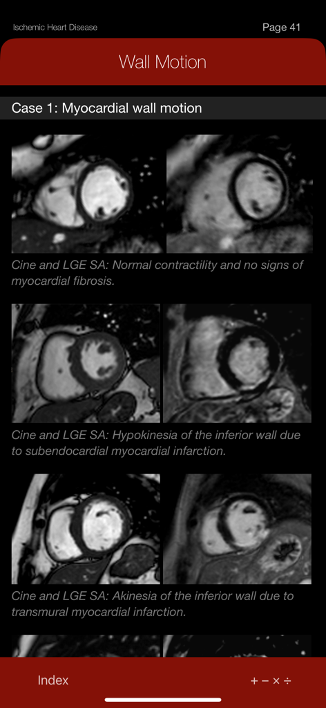 CMR Pocket Guide - CMRポケットガイド医療アプリ。心筋壁運動の症例と臨床心臓MRI画像が表示されています。