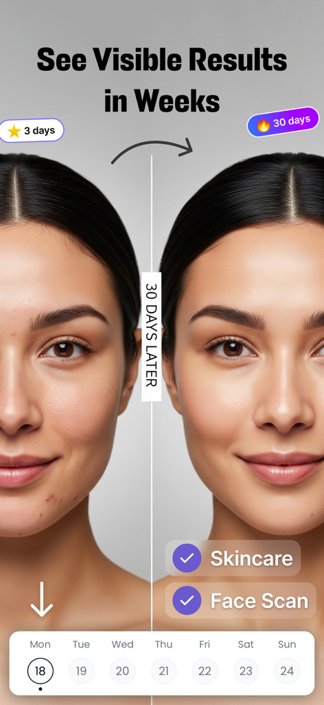 SkinPal AI: Skin Care Scanner - Before and after skin comparison showing visible results in thirty days