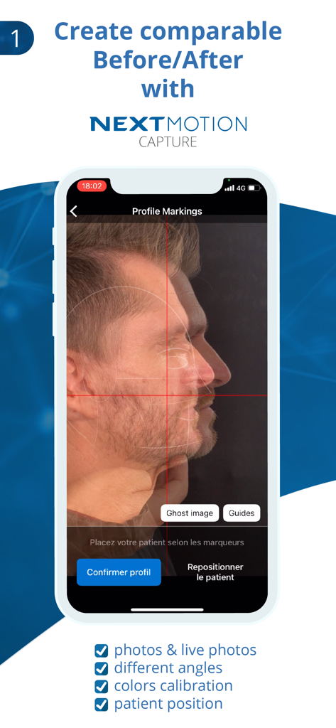 NM Capture mobile app interface displaying patient profile markings and ghost image overlay for consistent before and after photos