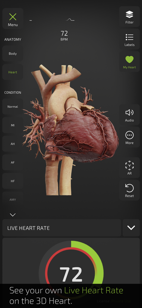 INSIGHT HEART - A detailed 3D human heart model with a live heart rate interface and medical condition toggles.