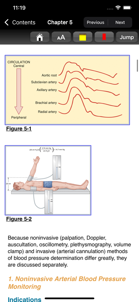 Captura de pantalla de la aplicación Clinical Anesthesiology que muestra formas de onda de presión arterial y diagramas de monitorización de la presión arterial
