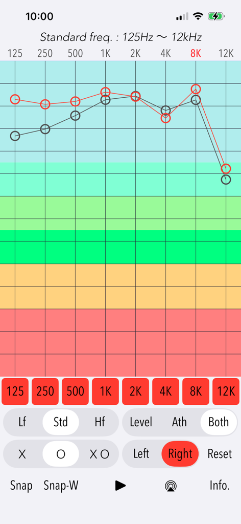 125Hzから12kHzまでの周波数に対する聴力検査結果を示す詳細な周波数応答グラフ