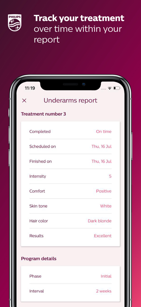 Ecrã de relatório de tratamento de axilas na aplicação Philips Lumea IPL que apresenta os detalhes da sessão e o acompanhamento do progresso