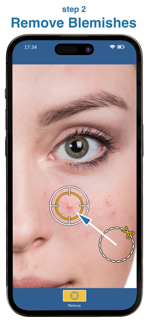 Blemish Remover Photo Tool - Pantalla de smartphone mostrando una herramienta de retoque de piel eliminando una imperfección de un rostro