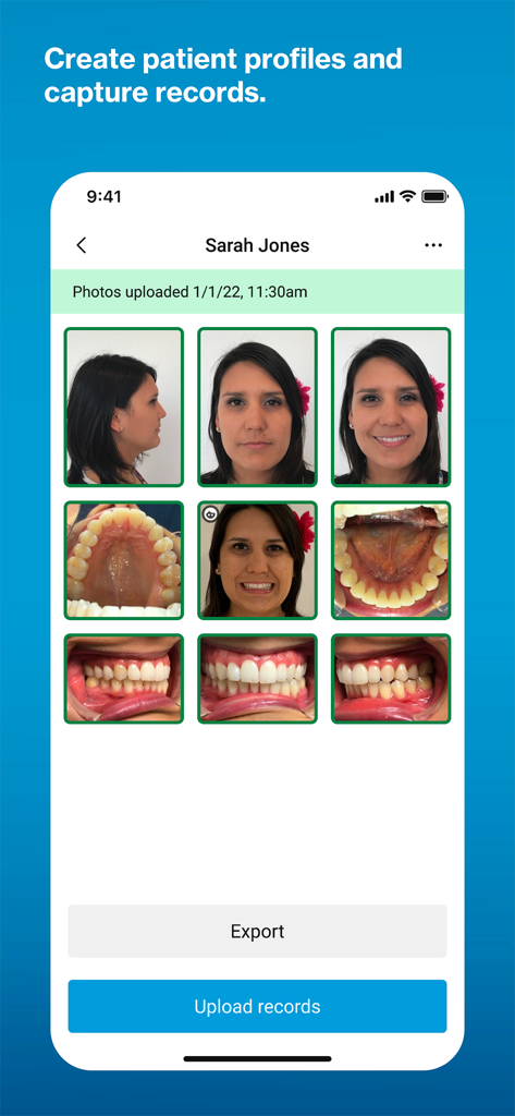 Invisalign Practice App - Interfaz de la App de Práctica Invisalign que muestra fotos clínicas de pacientes y botones para cargar registros.
