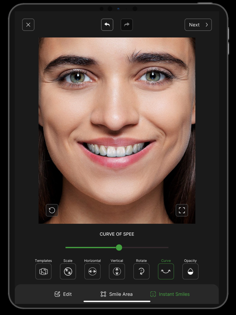 Instant Smiles - Curve of Spee 도구를 사용하여 디지털 스마일 목업을 조정하는 것을 보여주는 Instant Smiles 앱의 인터페이스