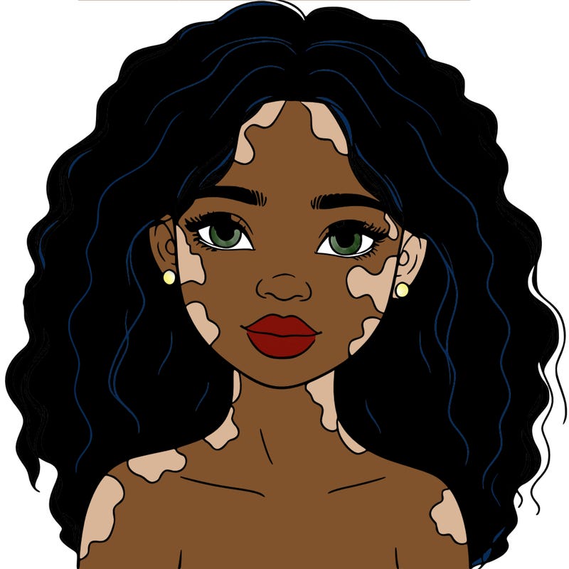 beautiful black girl with vitiligo