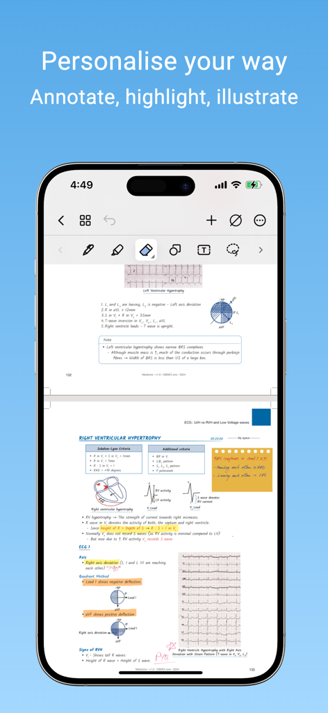 DBMCI One Notes: NEET PG, FMGE - iPhone screen displaying medical study notes for NEET PG and FMGE with annotation and highlighting tools