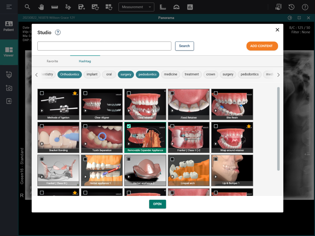 La interfaz de EzDent Web Studio que muestra una biblioteca de aparatos dentales y de ortodoncia para la consulta del paciente.