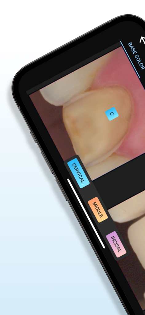 Matisse | Shade Matching - Mobile interface for dental shade matching showing a tooth with cervical middle and incisal zones