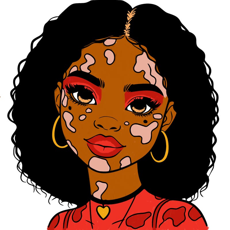 bleautiful black girl with vitiligo