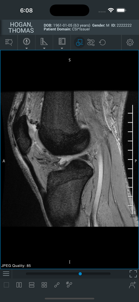 ResolutionMD - ResolutionMD mobile app displaying a medical MRI scan of a knee joint with diagnostic tools and patient information