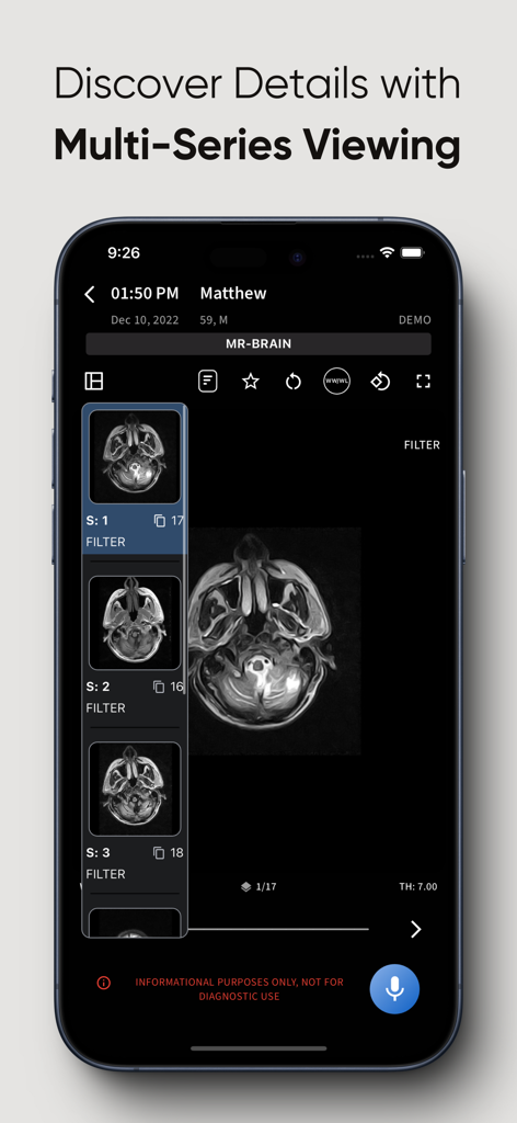 RadioView.AI app displaying a multi-series brain MRI scan on an iPhone